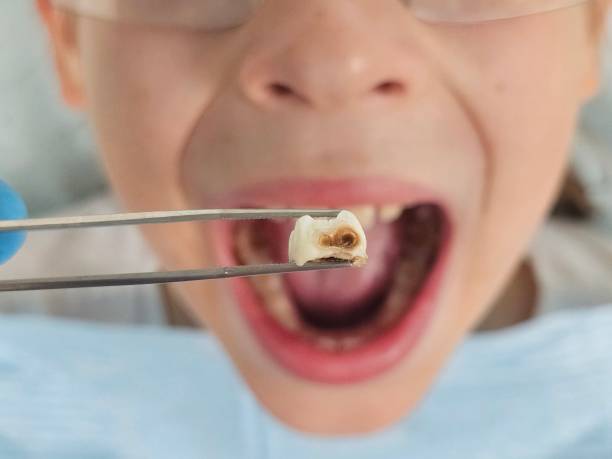Best Emergency Cosmetic Dentistry in Sellersburg, IN